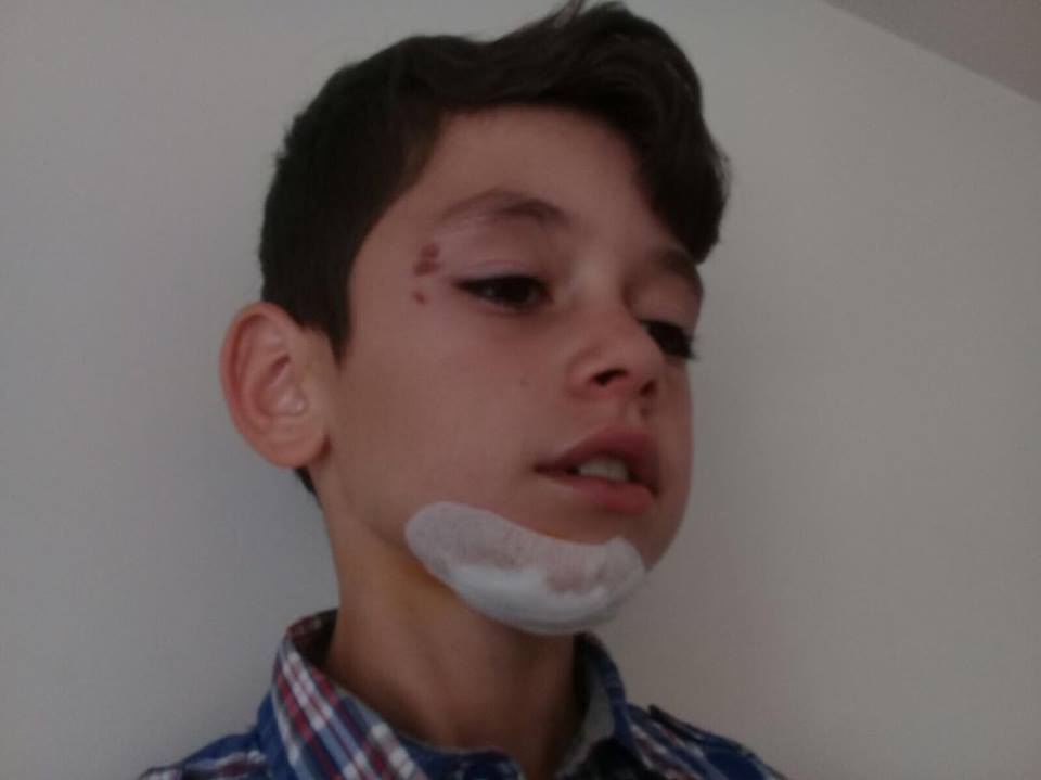 Suriyeli Çocuk Cetvelle Yaraladı
