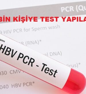 Kırıkkale’de ELİSA ve PCR Testleri Yapılacak